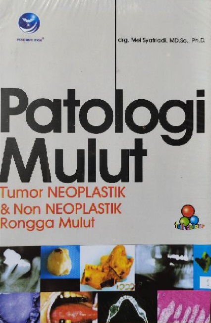 Cover Patologi Mulut :  Tumor Neoplastik & Nonplastik Rongga Mulut / Mei Syafriadi