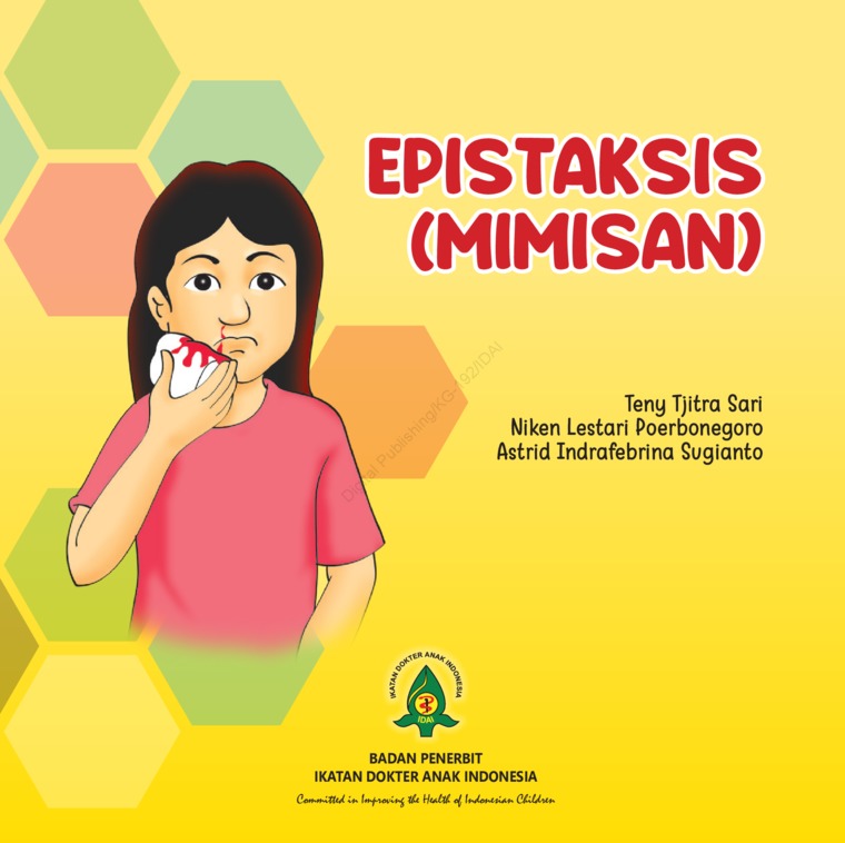 Cover Epistaksis (mimisan) :  - / Teny tjitra sari