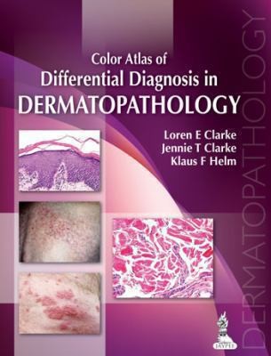 Cover Color Atlas Of Differential Diagnosis In Exfoliative and Aspiration Cytopathology :  - / Sudha R Kini