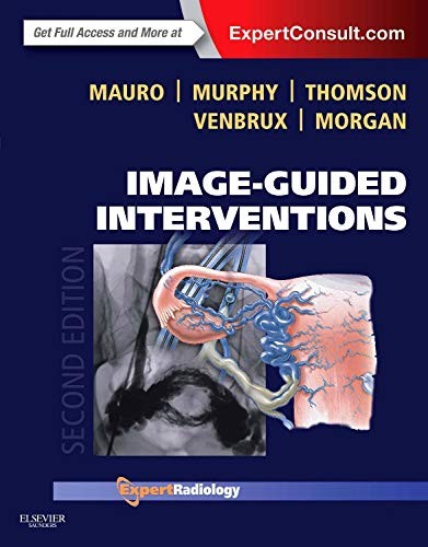 Cover Image-Guided Interventions: Expert Radiology Series (Expert Consult - Online And Print) 2nd Edition :  - / Mauro