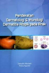Cover Pendekatan Dermatologi & Imunologi Dermatiti Atopik Pada Anak :  - / Zakiudin Munasir
