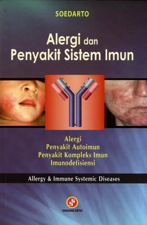 Cover Alergi Dan Penyakit Sistem Imun :  - / Soedarto