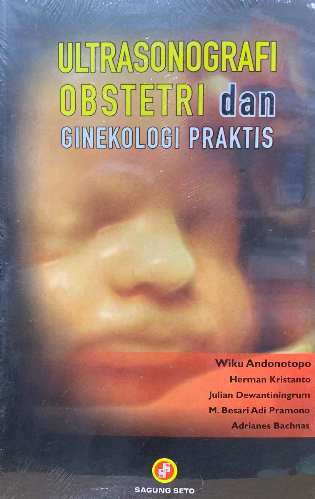 Cover Ultrasonografi Obstetri Dan Ginekologi Praktis :  - / Wiku Andono